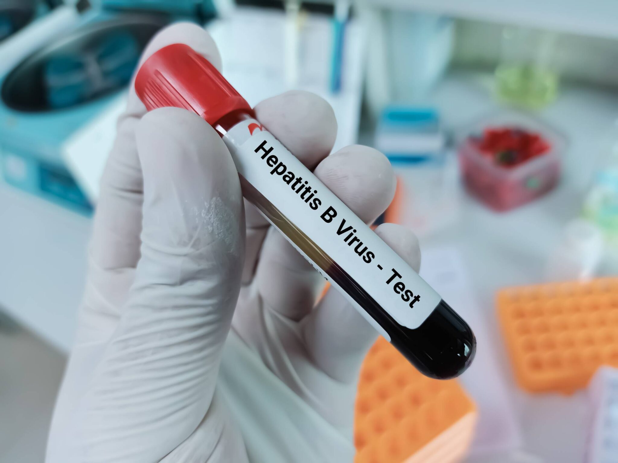 Hepatitis b hope travel clinic